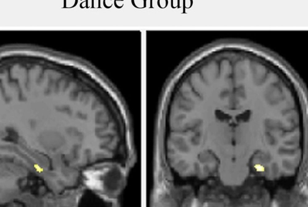 Danza multisensoriale e cervello
